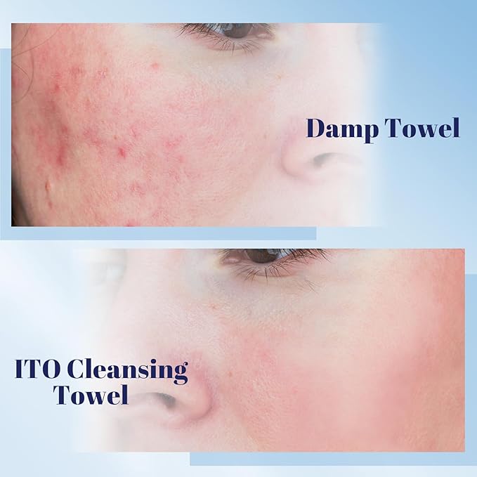 ITO Disposable Face Towel, Ultra-Soft 1-Second Quick-Dry Face Towels, Gentle for Sensitive Dry Oily Skin, Facial Towels for Daily Cleansing Makeup Removal (60 Count (Pack of 1))