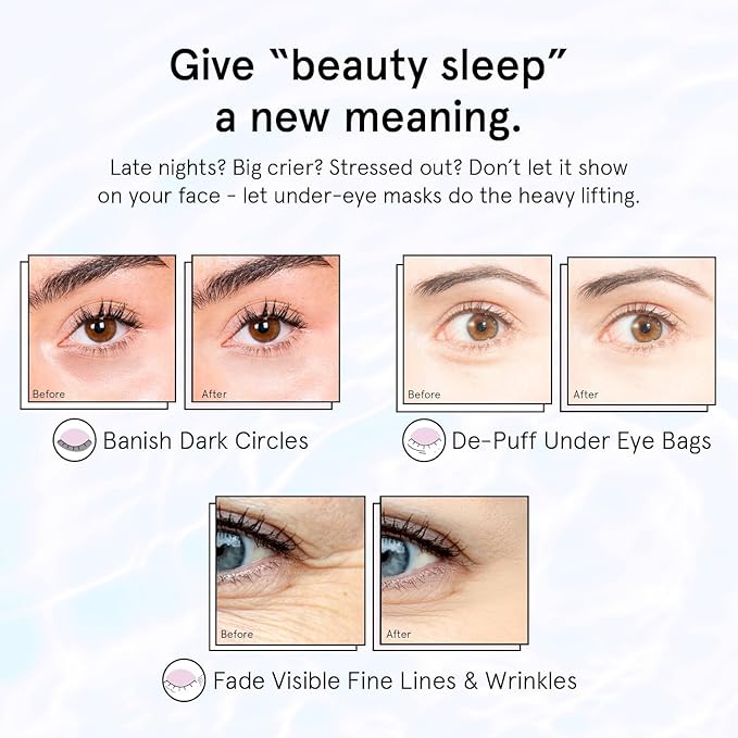 grace & stella Retinol Under Eye Patches for Puffy Eyes and Dark Circles - Restoring Gel Under Eye Masks with Hyaluronic Acid - Vegan Cruelty-Free Skincare - Birthday Gifts for Women (Purple, 6 Pairs)